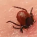 Tick Fever – Dr Dick Stockley