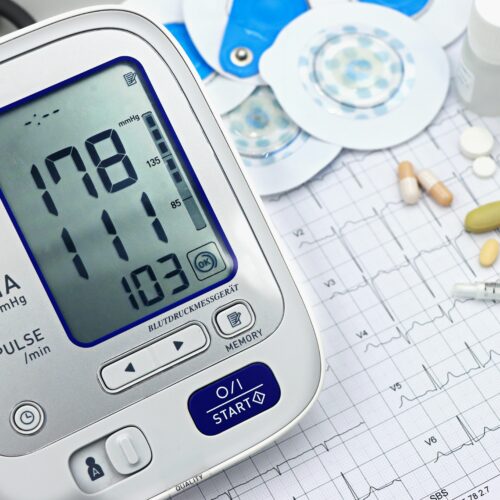 Silent Risks: Why Your “Pressure” Needs a Specialist’s Eye